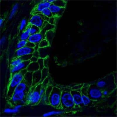 Immunocytochemistry/ Immunofluorescence: CD44 Antibody (8E2F3) - BSA Free [NBP1-47386]