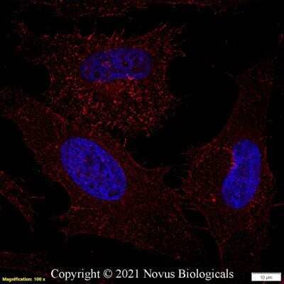 Immunocytochemistry/ Immunofluorescence: CD44 Antibody (8E2F3) - BSA Free [NBP1-47386]