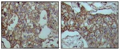 Immunohistochemistry-Paraffin: CD44 Antibody (8E2F3) - BSA Free [NBP1-47386]