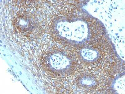 Immunohistochemistry-Paraffin: CD44 Antibody (CD44v4/1219) - variant 4 - Azide and BSA Free [NBP2-54581]