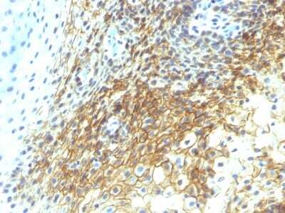 Immunohistochemistry-Paraffin: CD44 Antibody (CD44v4/1219) - variant 4 - Azide and BSA Free [NBP2-54581]