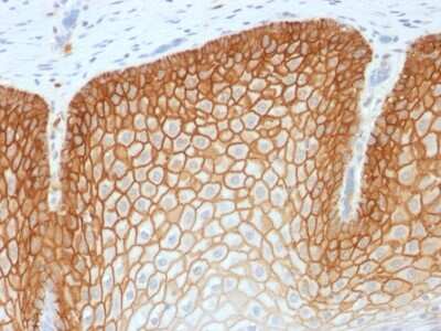 Immunohistochemistry-Paraffin: CD44 Antibody (CD44v4/1700R) - variant 4 - Azide and BSA Free [NBP2-54586]