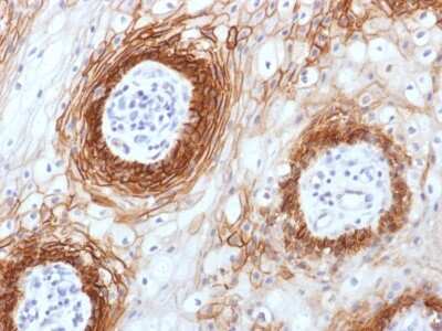 Immunohistochemistry-Paraffin: CD44 Antibody (CD44v6/1246) - variant 6 [NBP2-53203]