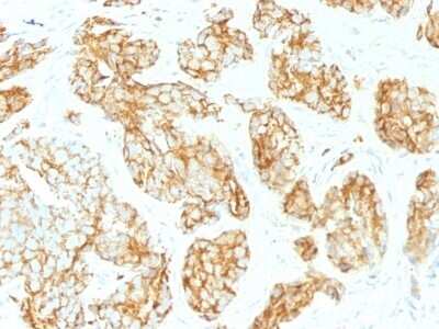 Immunohistochemistry-Paraffin: CD44 Antibody (CD44v9/1459) - variant 9 - Azide and BSA Free [NBP2-54571]