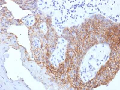 Immunohistochemistry-Paraffin: CD44 Antibody (CD44v9/1459) - variant 9 - Azide and BSA Free [NBP2-54571]