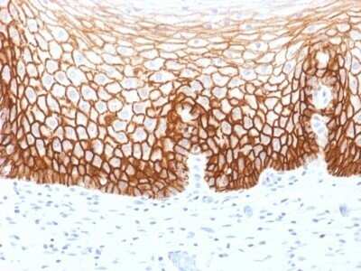 Immunohistochemistry-Paraffin: CD44 Antibody (CD44v9/1459) - variant 9 [NBP2-53204]