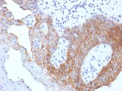 Immunohistochemistry-Paraffin: CD44 Antibody (CD44v9/1459) - variant 9 [NBP2-53204]