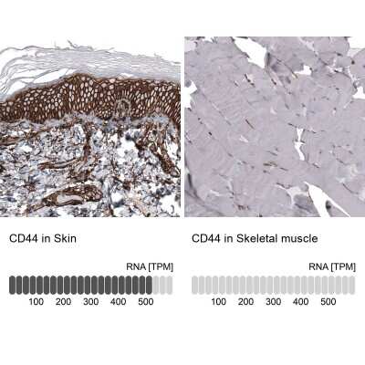 Immunohistochemistry-Paraffin: CD44 Antibody (CL13319) [NBP3-18578]