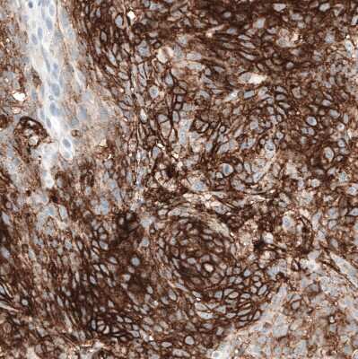 Immunohistochemistry-Paraffin: CD44 Antibody (CL13319) [NBP3-18578]