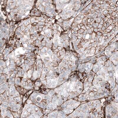 Immunohistochemistry-Paraffin: CD44 Antibody (CL13319) [NBP3-18578]