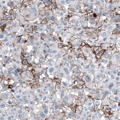 Immunohistochemistry-Paraffin: CD44 Antibody (CL13319) [NBP3-18578]