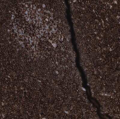 Immunohistochemistry-Paraffin: CD44 Antibody (CL13319) [NBP3-18578]