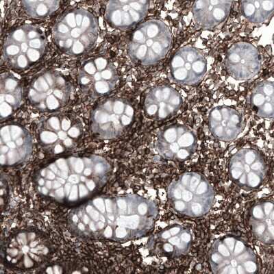 Immunohistochemistry-Paraffin: CD44 Antibody (CL13319) [NBP3-18578]