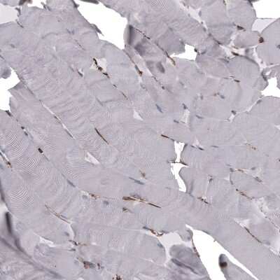 Immunohistochemistry-Paraffin: CD44 Antibody (CL13319) [NBP3-18578]