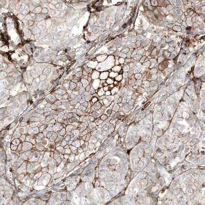 Immunohistochemistry-Paraffin: CD44 Antibody (CL13318) [NBP3-18580]
