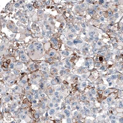 Immunohistochemistry-Paraffin: CD44 Antibody (CL13318) [NBP3-18580]