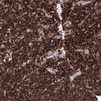 Immunohistochemistry-Paraffin: CD44 Antibody (CL13318) [NBP3-18580]