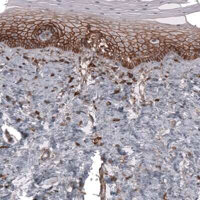 Immunohistochemistry-Paraffin: CD44 Antibody (CL13318) [NBP3-18580]