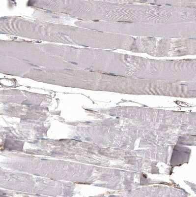 Immunohistochemistry-Paraffin: CD44 Antibody (CL13318) [NBP3-18580]