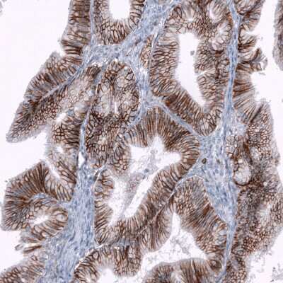 Immunohistochemistry-Paraffin: CD44 Antibody (CL13324) [NBP3-18566]