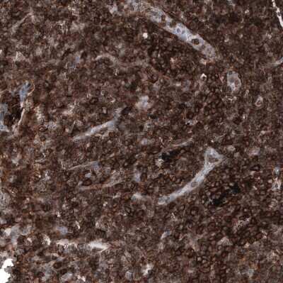 Immunohistochemistry-Paraffin: CD44 Antibody (CL13324) [NBP3-18566]