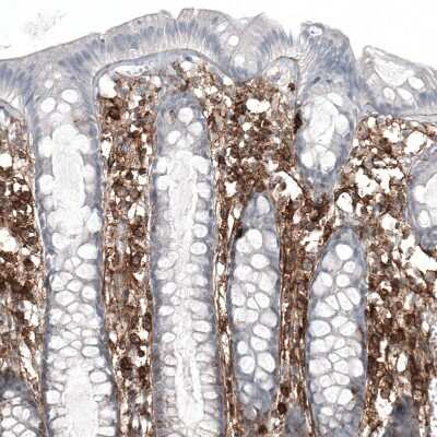 Immunohistochemistry-Paraffin: CD44 Antibody (CL13324) [NBP3-18566]