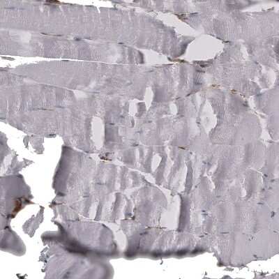 Immunohistochemistry-Paraffin: CD44 Antibody (CL13324) [NBP3-18566]