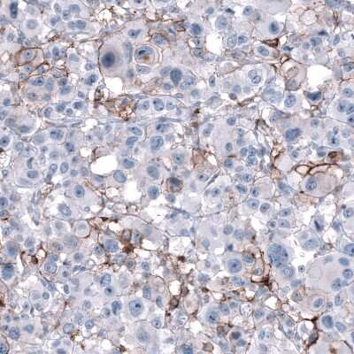 Immunohistochemistry-Paraffin: CD44 Antibody (CL13328) [NBP3-18558]