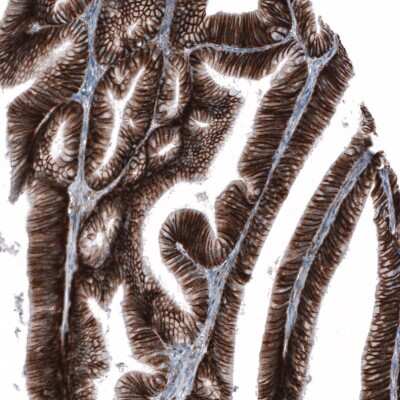 Immunohistochemistry-Paraffin: CD44 Antibody (CL13328) [NBP3-18558]