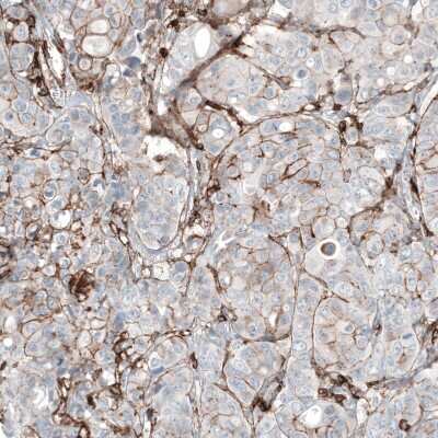 Immunohistochemistry-Paraffin: CD44 Antibody (CL13328) [NBP3-18558]