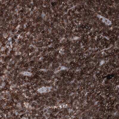 Immunohistochemistry-Paraffin: CD44 Antibody (CL13328) [NBP3-18558]