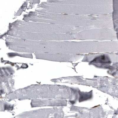 Immunohistochemistry-Paraffin: CD44 Antibody (CL13328) [NBP3-18558]