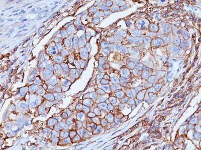 Immunohistochemistry-Paraffin: CD44 Antibody (DF1485) - IHC-Prediluted [NBP2-48420]