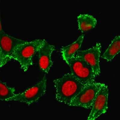 Immunocytochemistry/ Immunofluorescence: CD44 Antibody (DF1485) [NBP2-44653]