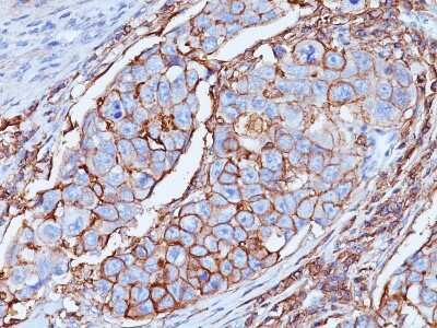 Immunohistochemistry-Paraffin: CD44 Antibody (DF1485) [NBP2-44653]