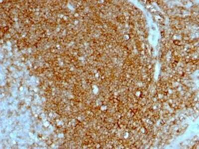 Immunohistochemistry-Paraffin: CD44 Antibody (HCAM/1097) - IHC-Prediluted [NBP2-48421]