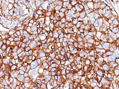 Immunohistochemistry-Paraffin: CD44 Antibody (HCAM/918) - IHC-Prediluted [NBP2-48408]