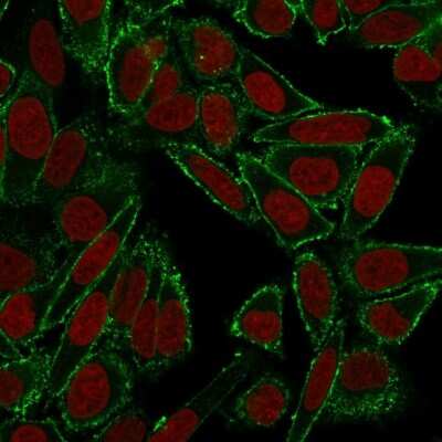 Immunocytochemistry/ Immunofluorescence: CD44 Antibody (HCAM/918) [NBP2-44652]