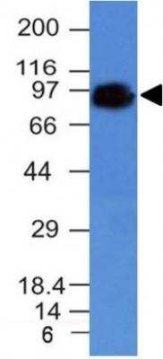 Western Blot: CD44 Antibody (HCAM/918) [NBP2-44652]