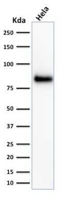Western Blot: CD44 Antibody (HCAM/918) [NBP2-44652]