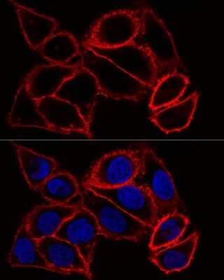 Immunocytochemistry/ Immunofluorescence: CD44 Antibody - Azide and BSA Free [NBP2-92947]