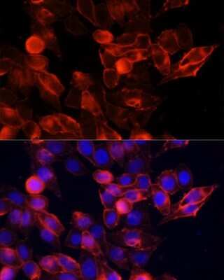 Immunocytochemistry/ Immunofluorescence: CD44 Antibody - Azide and BSA Free [NBP2-92947]