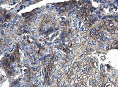 Immunohistochemistry-Paraffin: CD44 Antibody [NBP1-31488]