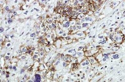 Immunohistochemistry-Paraffin: CD44 Antibody [NBP1-31488]