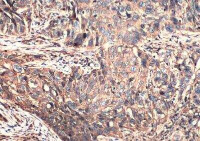 Immunohistochemistry-Paraffin: CD44 Antibody [NBP1-31488]