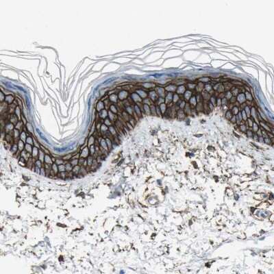 Immunohistochemistry-Paraffin: CD44 Antibody [NBP1-84578]