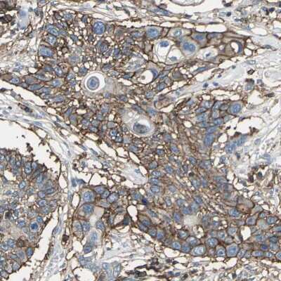 Immunohistochemistry-Paraffin: CD44 Antibody [NBP1-84578]
