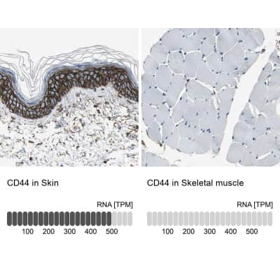 Immunohistochemistry-Paraffin: CD44 Antibody [NBP1-84578]