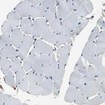 Immunohistochemistry-Paraffin: CD44 Antibody [NBP1-84578]