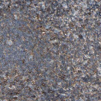 Immunohistochemistry-Paraffin: CD44 Antibody [NBP1-84578]